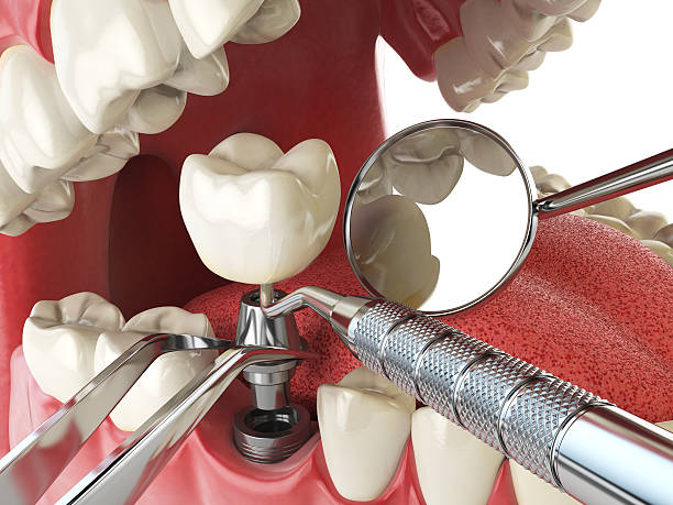 Best Emergency Gum Treatment in Jackson, LA